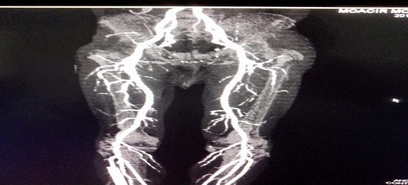 Angiotomografia Cerebral do Crânio e Tórax O que é Preço Sky Nerd